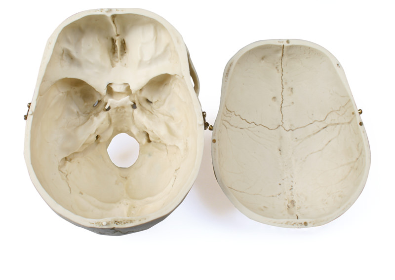 Erwachsenenschädel, männlich